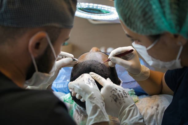 Une greffe de cheveux mal réalisée peut laisser des séquelles visibles. En effet, les résultats peuvent sembler artificiels.